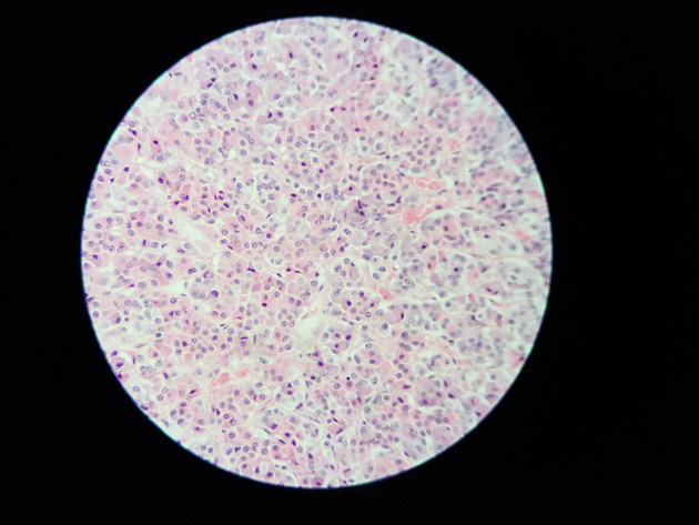 Pituitary Gland Slides - Pituitary Gland 015 400X